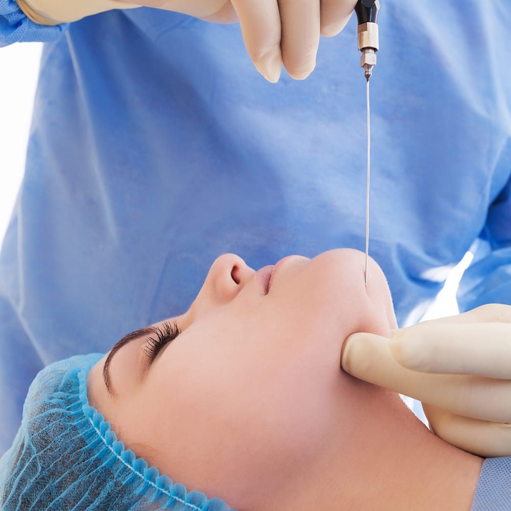 Lipolaser