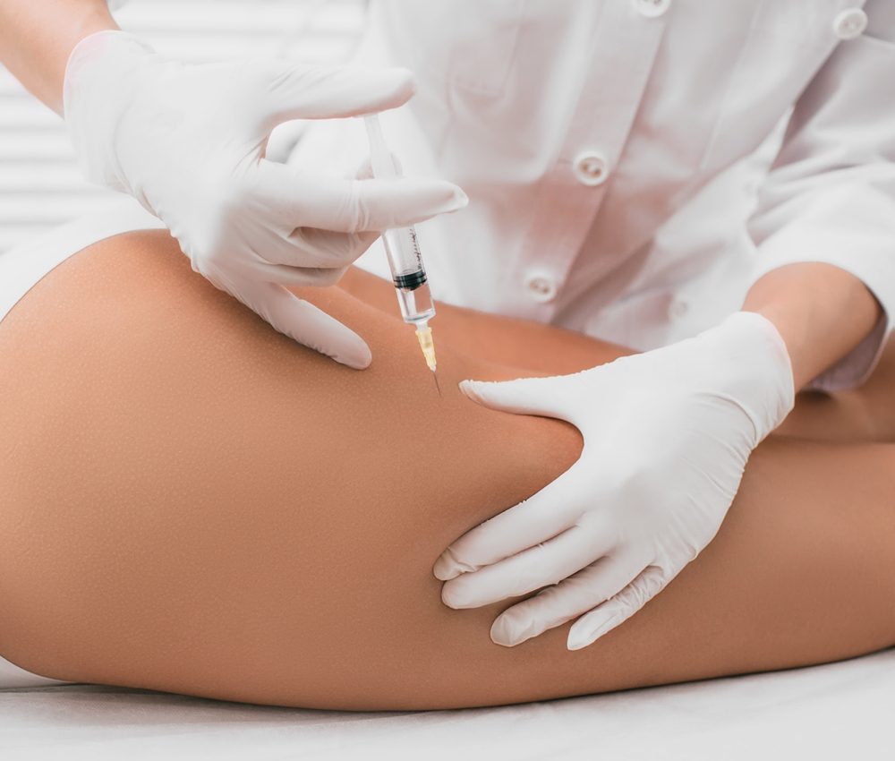 Mesoterapia