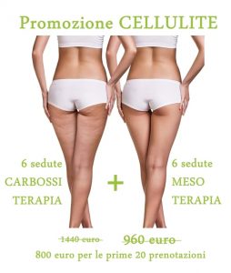 promozione cellulite padova carbossiterapia mesoterapia londeiclinic