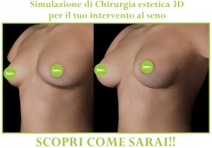 Simulatore chirurgia plastica 3d per interventi estetici al seno SCOPRI COME SARAI