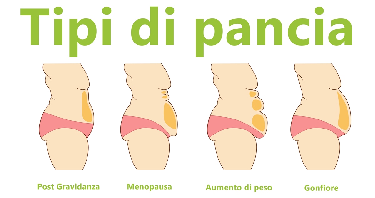 tipi di pancia infografica intervento addominoplastica