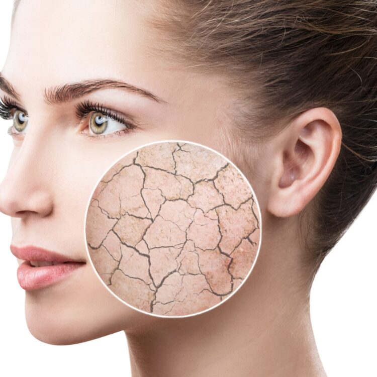 peeling chimico e biorivitalizzazione trattamento viso idratare pelle padova cagliari londeiclinic