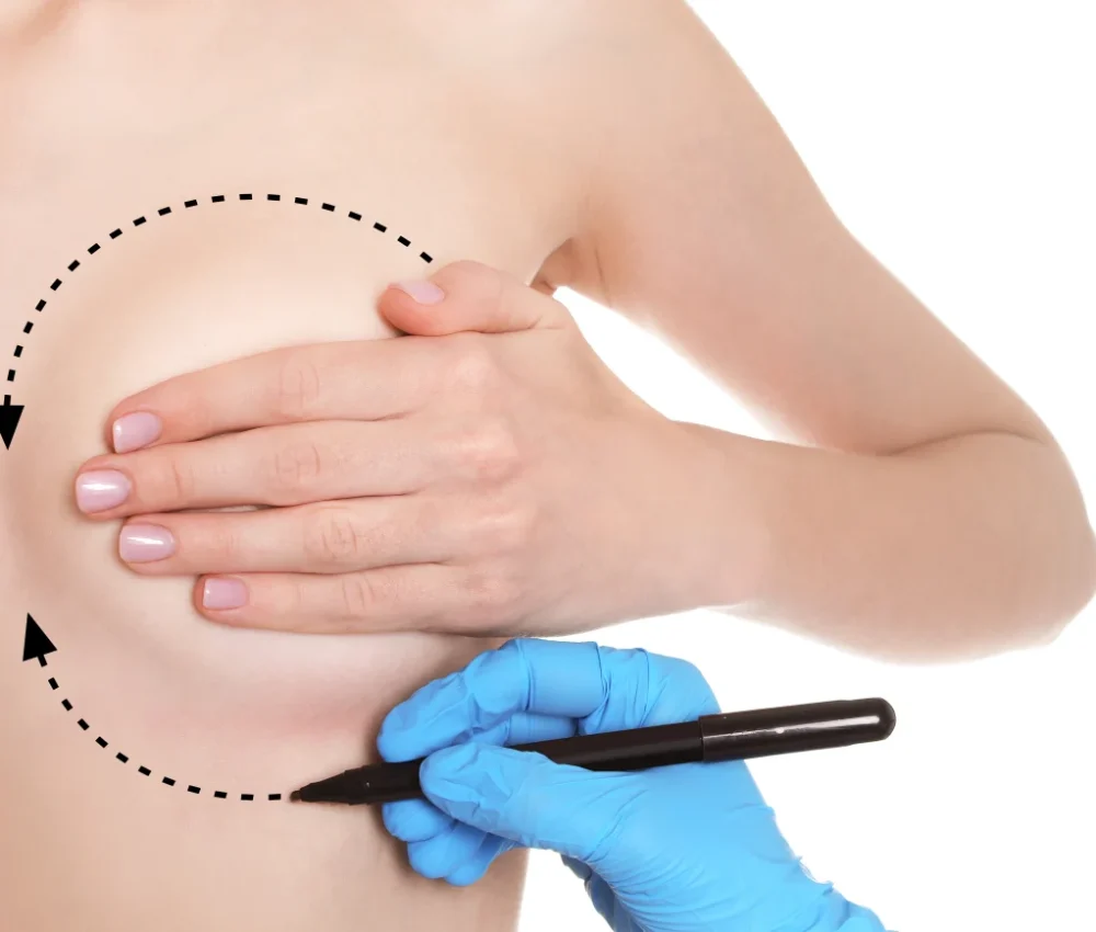 MINI MASTOPLASTICA ADDITIVA padova cagliari intervento londeiclinic